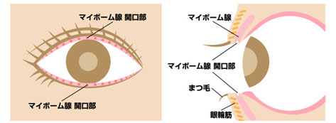 ドライアイ（IPL）治療